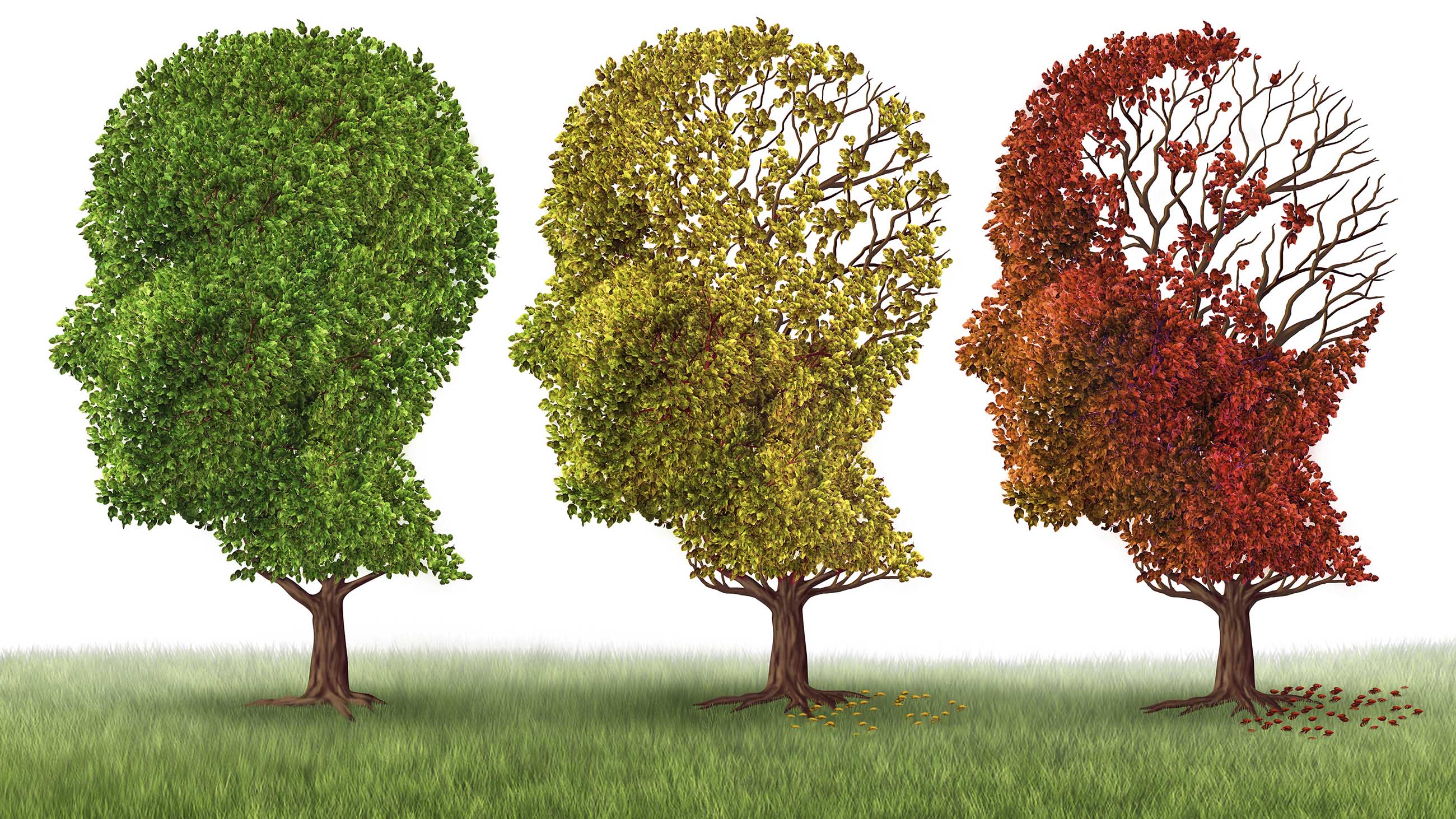 The First Wave In The Long Goodbye Of Alzheimer S Disease