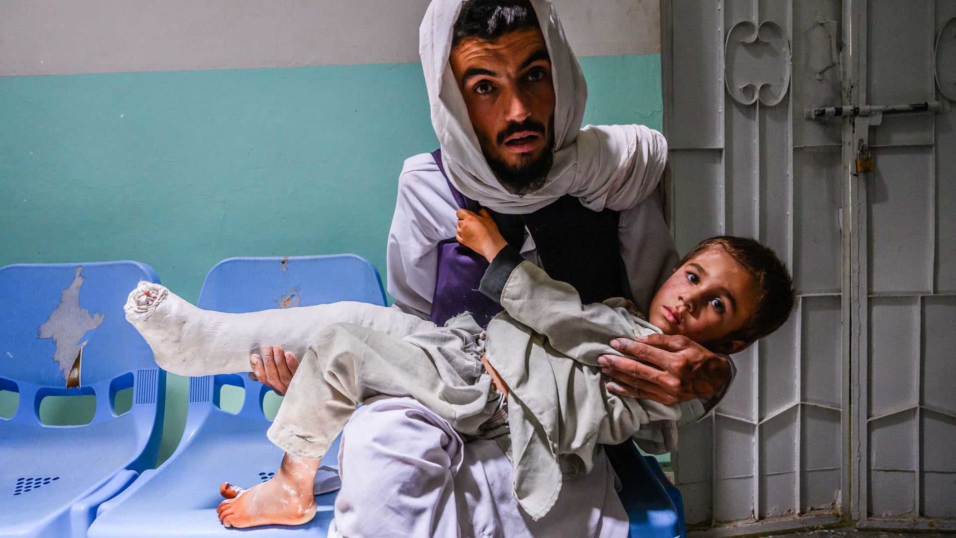 In a remote town in Kandahar, a father holds his son, who has just had a fresh cast put on his broken leg. The boy was lucky that the hospital could oblige.  (All images by Kern Hendricks for Undark)