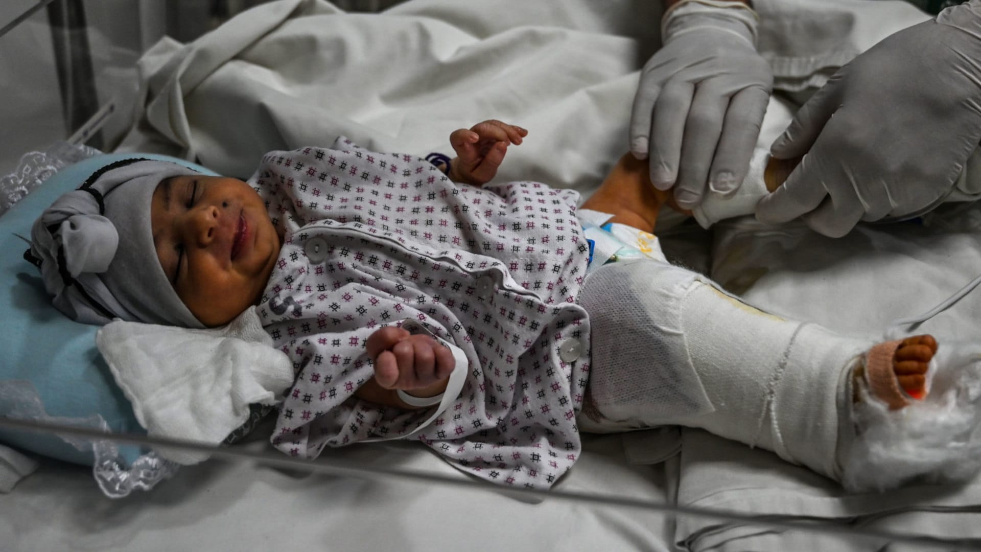 Rafiullah and Nazia's newborn, Amina, receives treatment for the gun wound in her leg at the French Medical Institute for Children in Kabul. Nazia was killed in the attack on a maternity ward of the Dasht-e-Barchi Hospital.