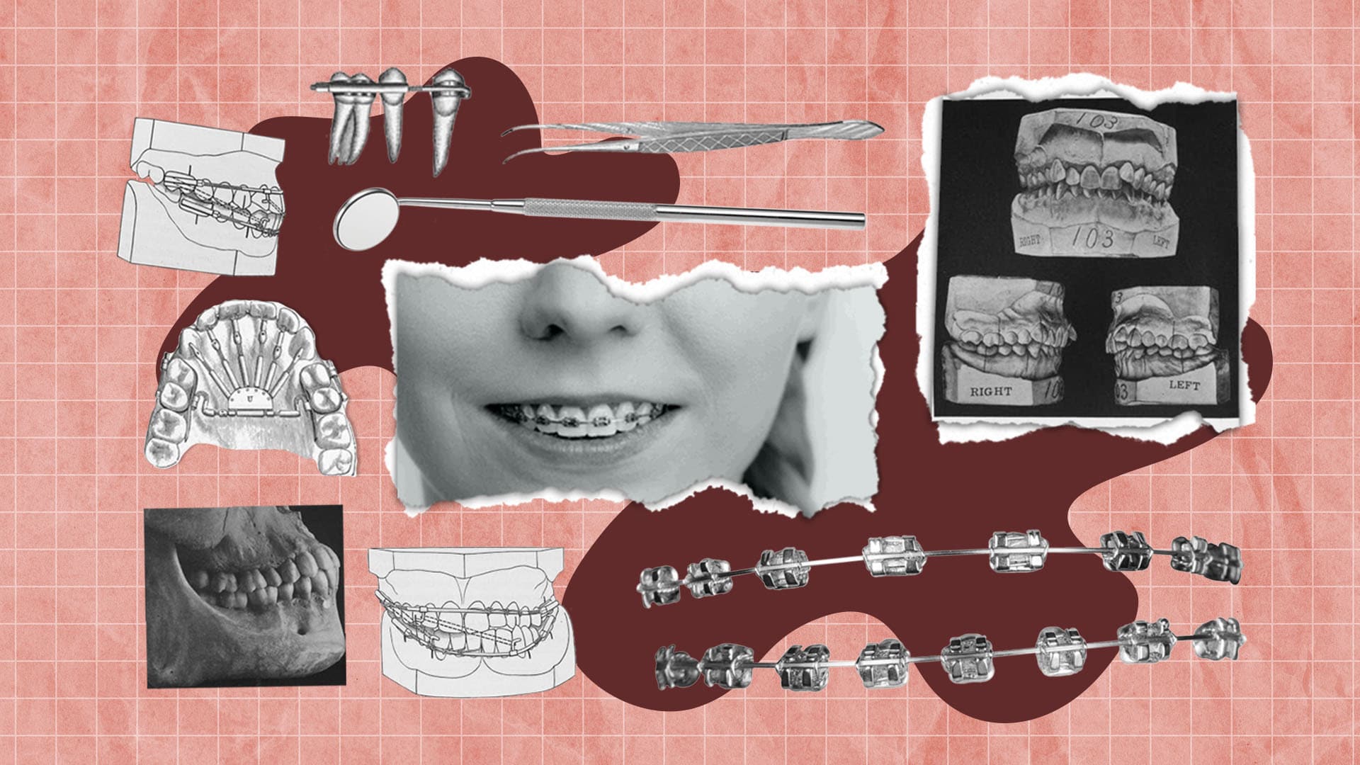 Orthodontic Web Design