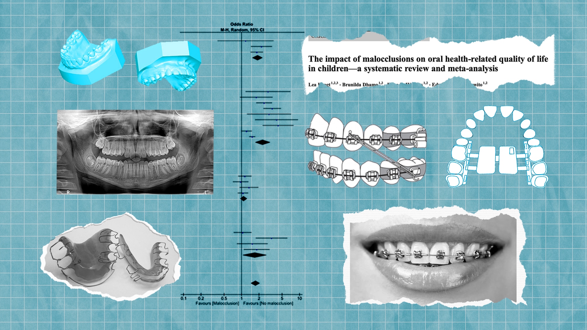 Lexington Braces