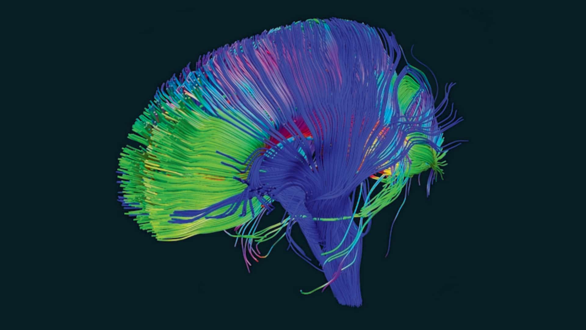 Neural pathways in the brain, determined from diffusion-tensor magnetic resonance imaging.