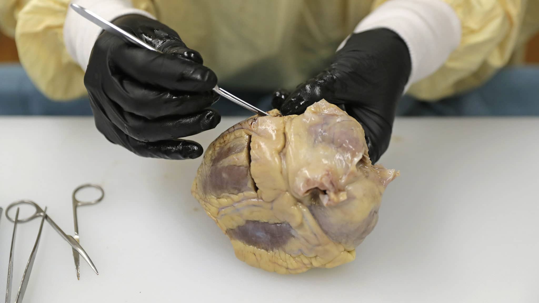 Dr. Desiree Marshall, director of Autopsy and After Death Services for University of Washington Medicine, examines the preserved heart of a person who died of Covid-19-related complications.