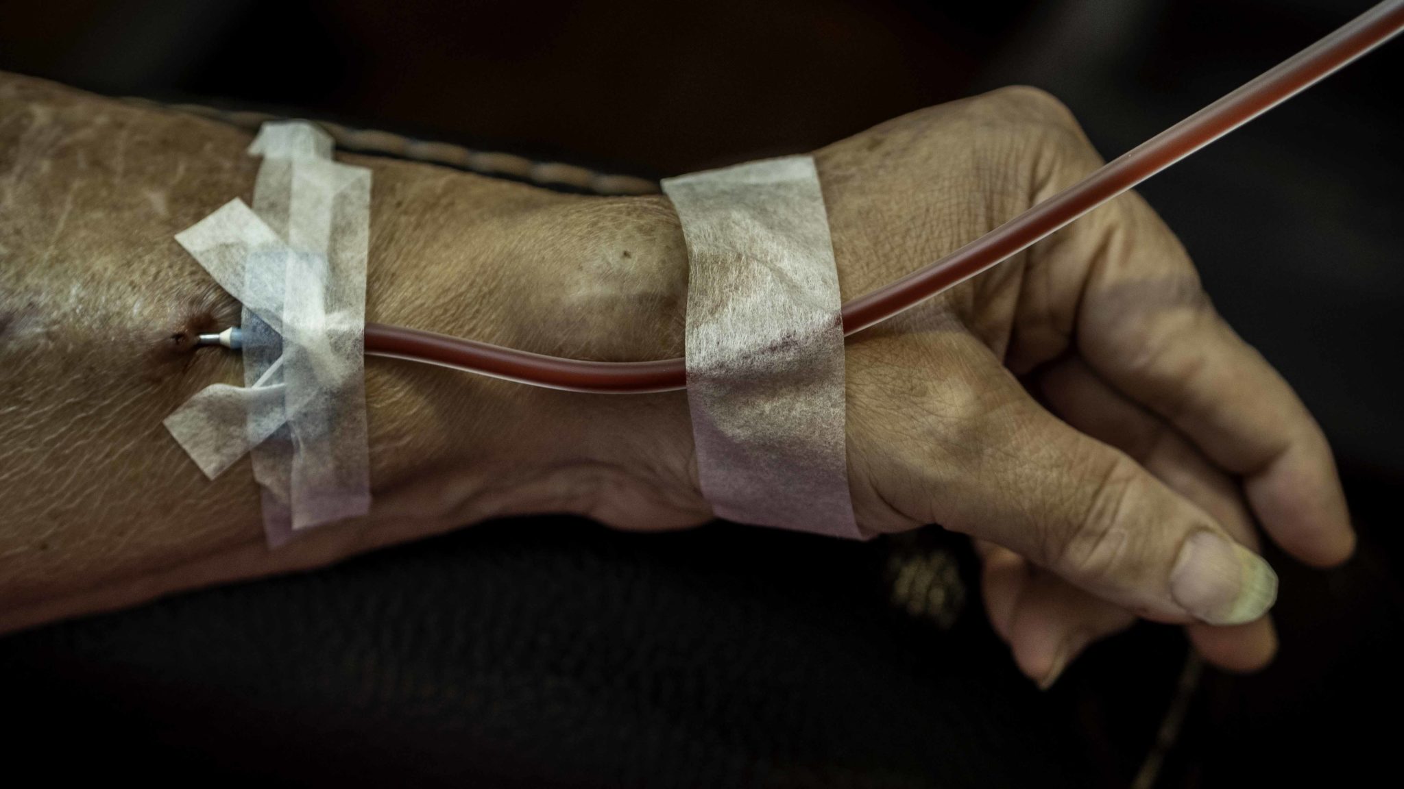 Jo Karabasz says she’s handled a lot in her 58 years of life, but when it comes to her dialysis, she needs things to go smoothly. “Just don’t fuss with me,” she said.