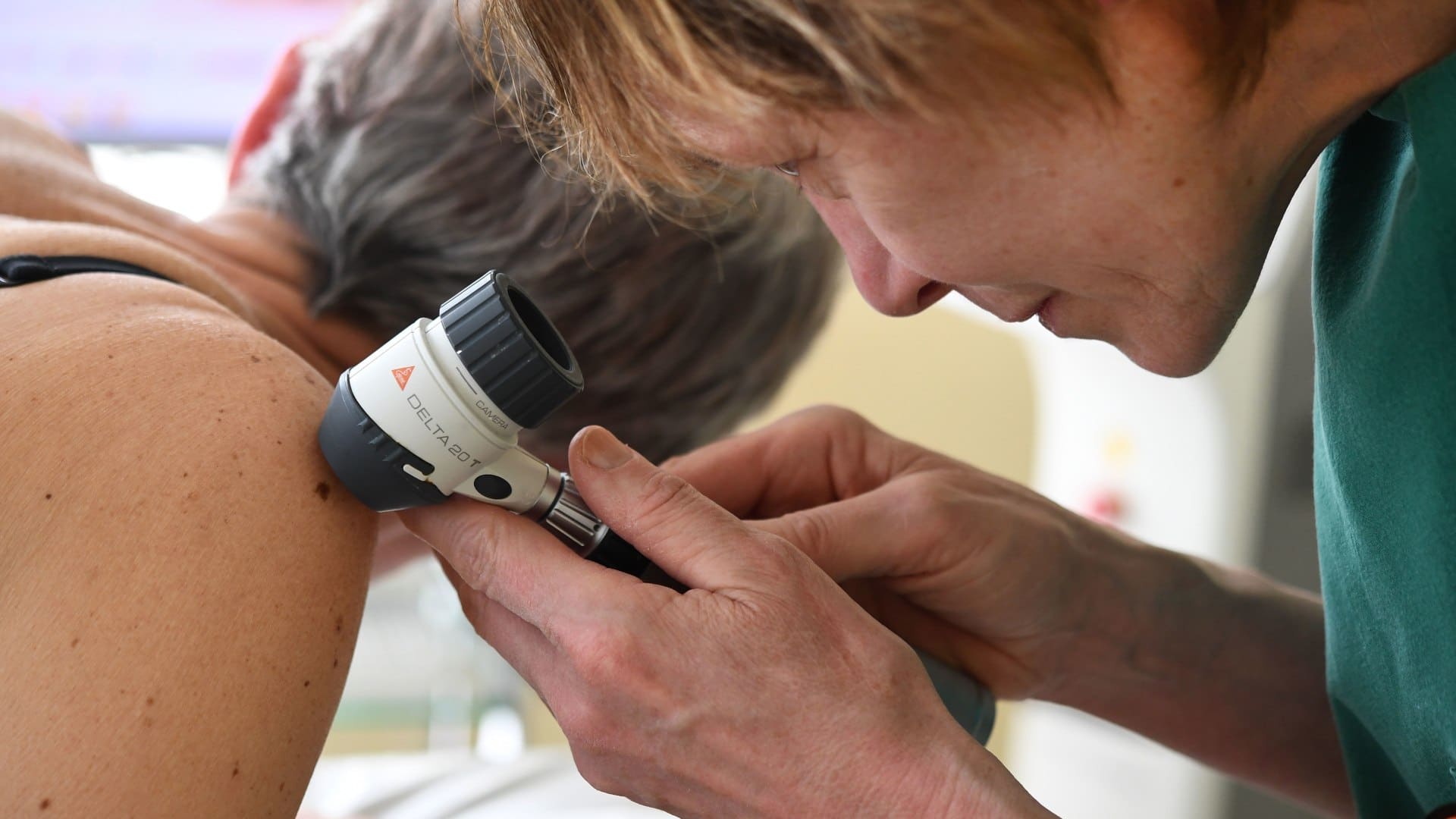 A dermatologist checks moles on a patient.