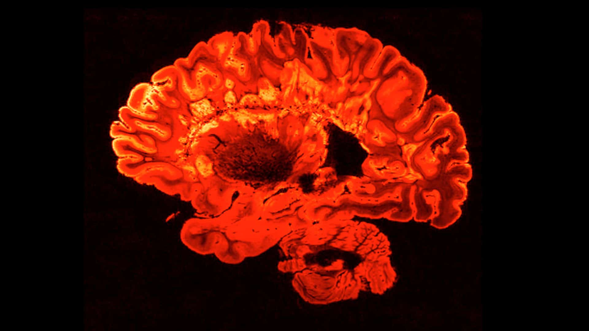 A image of the brain created through functional magnetic resonance imaging (fMRI).