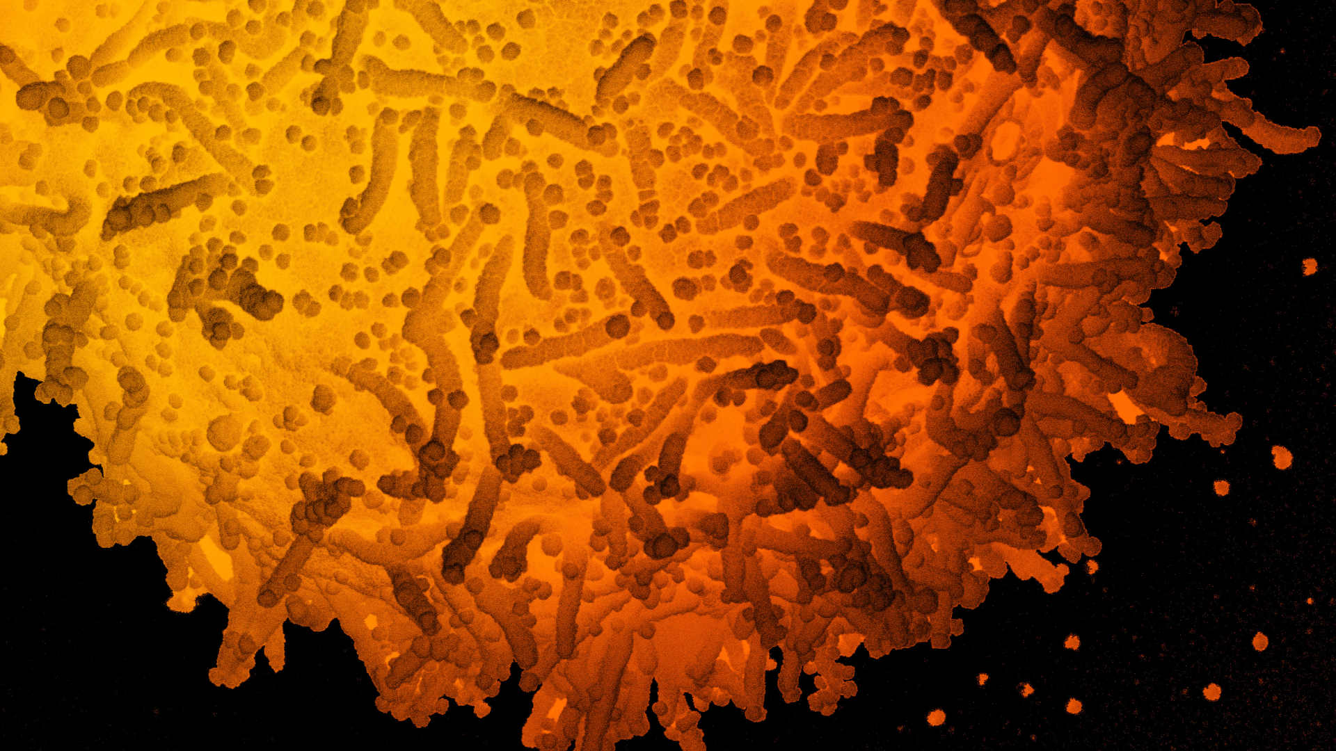 Color-enhanced scanning electron microscope image of a human cell infected with SARS-CoV-2 particles, isolated from a patient sample. Virus particles are the small, spherical structures found on the surface of the cell.