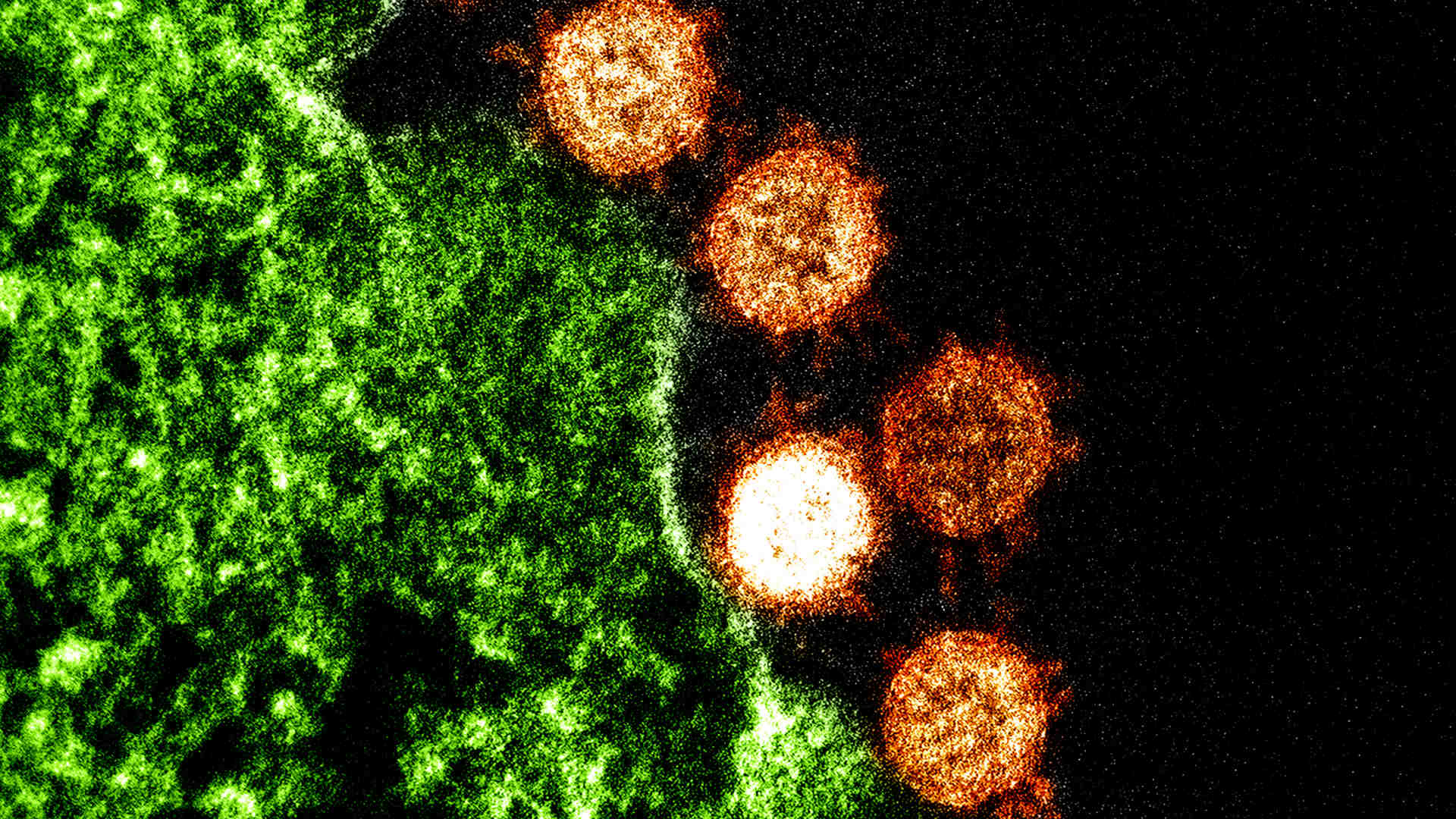 Electron microscope image of Severe Acute Respiratory Syndrome (SARS) virus particles (orange) found near an infected cell (green). Image captured and color-enhanced at the NIAID Integrated Research Facility in Fort Detrick, Maryland.