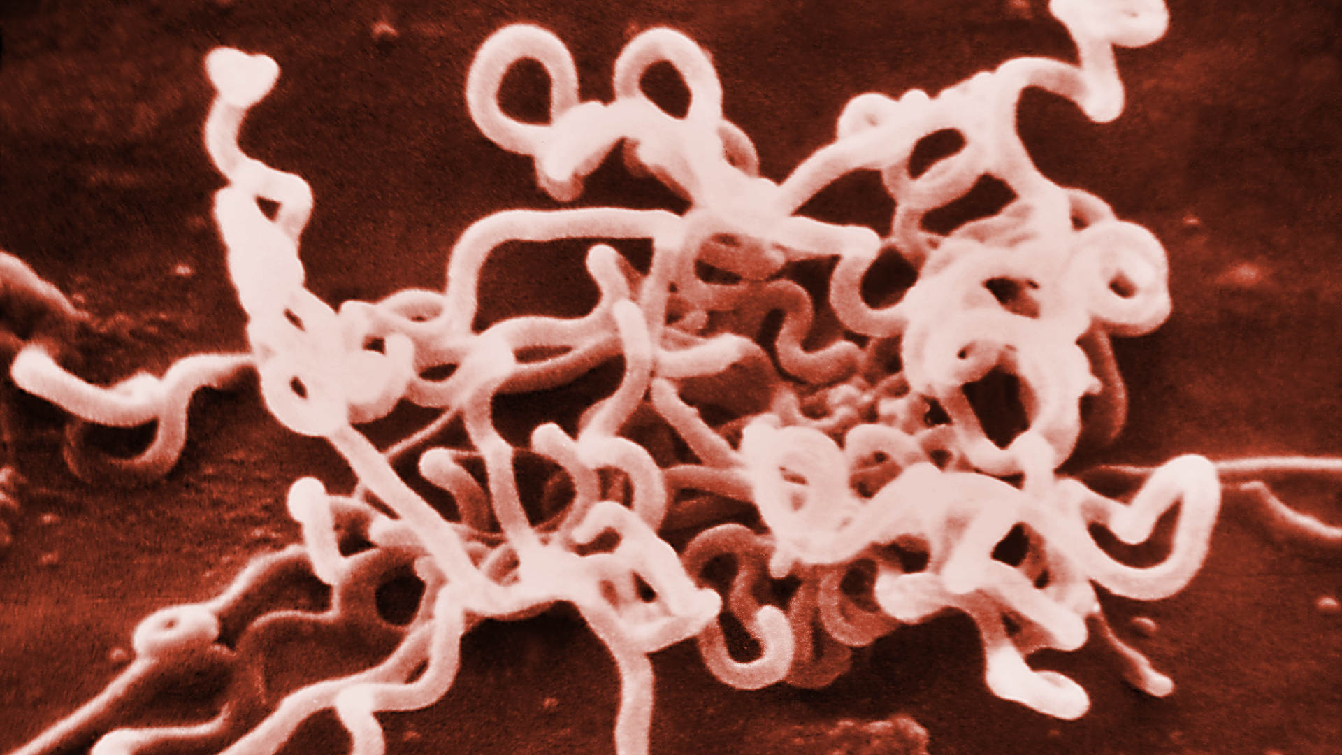 A false-color electron microscope image of the spiral-shaped Treponema pallidum bacteria, which causes syphilis.