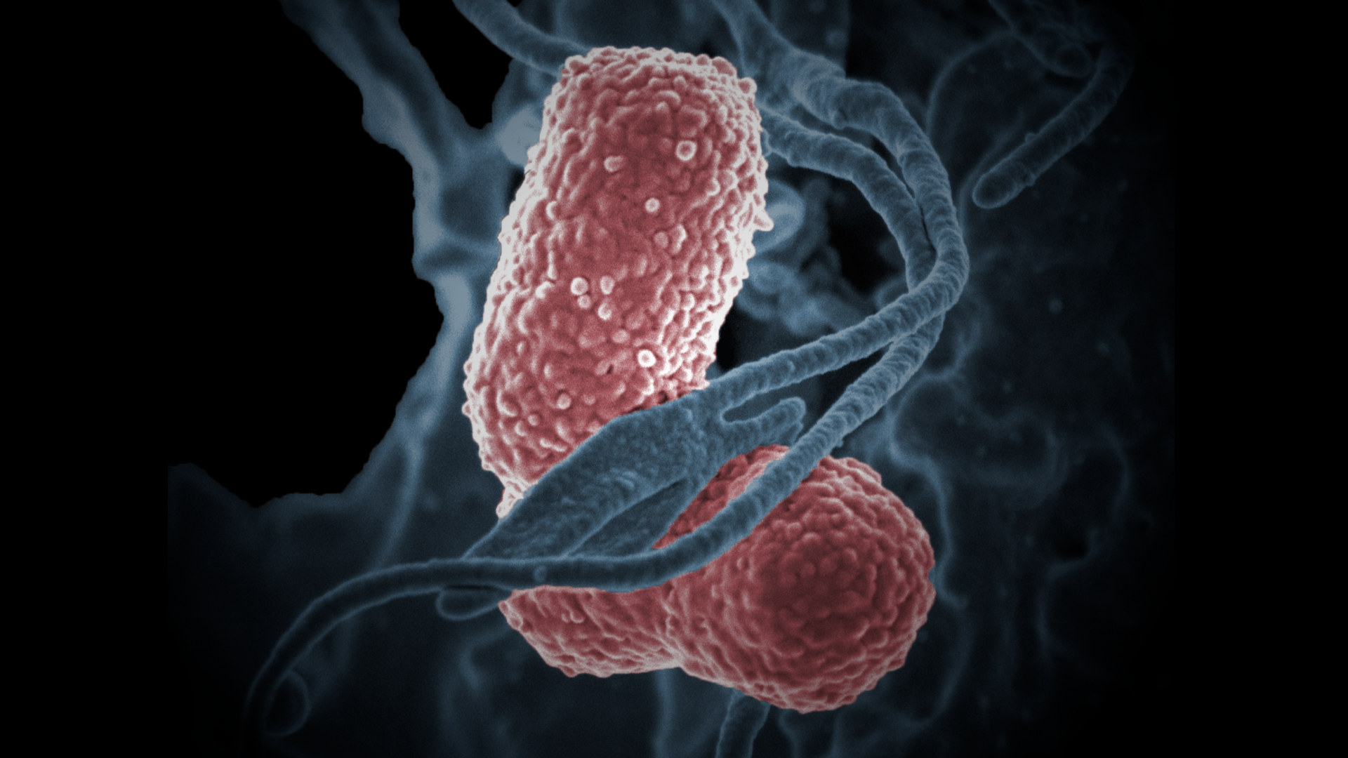 A human white blood cell (blue) interacting with Klebsiella pneumoniae (pink), a multidrug–resistant bacterium that causes severe hospital infections.
