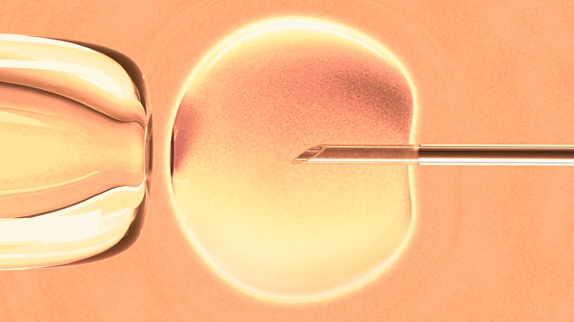 An illustration of in vitro fertilization, in which a single sperm is injected into an egg to create an embryo.