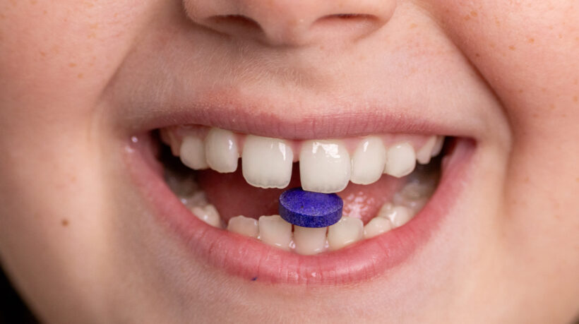 Detailed close-up of a person smiling with a purple pill balanced between their teeth