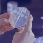 petri dish with several colonies growing