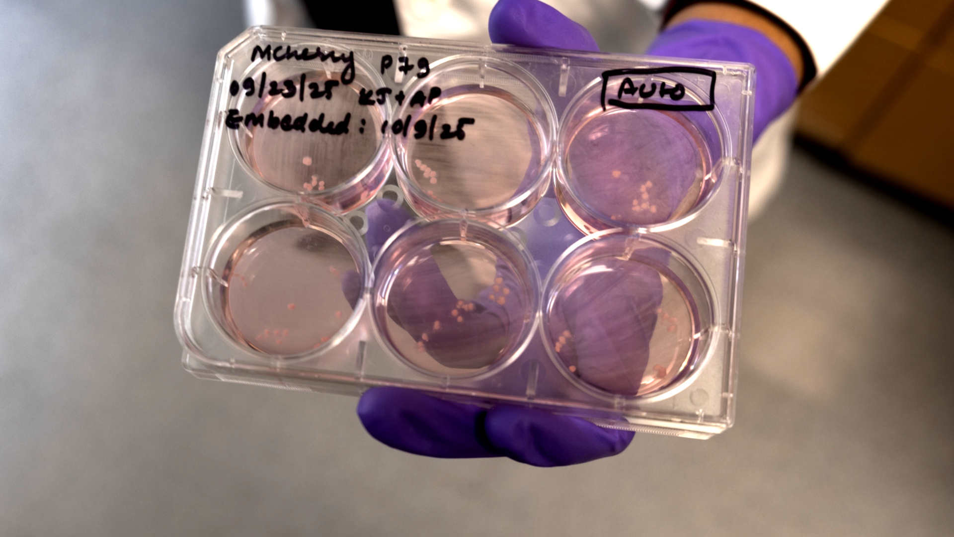 The Big Questions Surrounding Brain Organoid Research