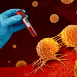 Cancer blood test and Multi malignant disease screening for early detection of cancers and cancerous tumor cells