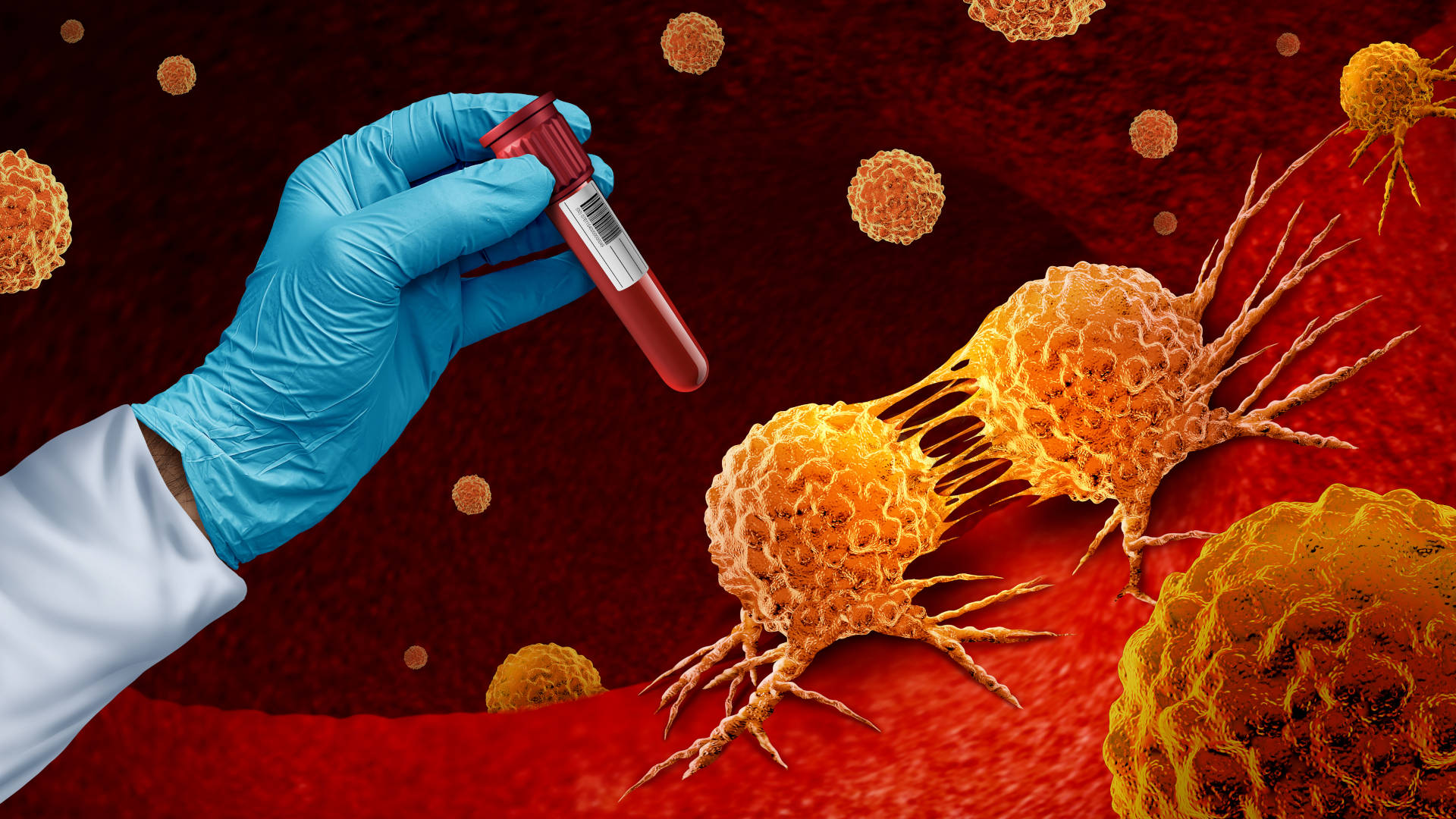 Cancer blood test and Multi malignant disease screening for early detection of cancers and cancerous tumor cells
